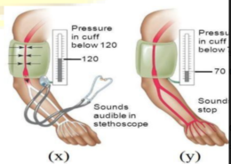 5.The force exerted by the blood against the wall of a vessel is called blood pressure. This pressure is much greater in arteries than in veins. The pressure of blood inside the artery during ventricular systole (contraction) is called systolic pressure and pressure in the artery during ventricular diastole (relaxation) is called diastolicpressure.
